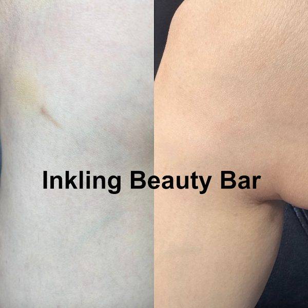 Inkling Beauty Bar