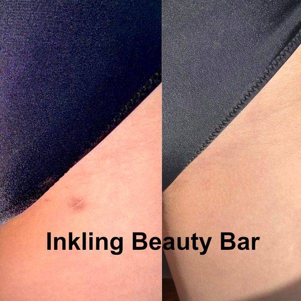 Inkling Beauty Bar