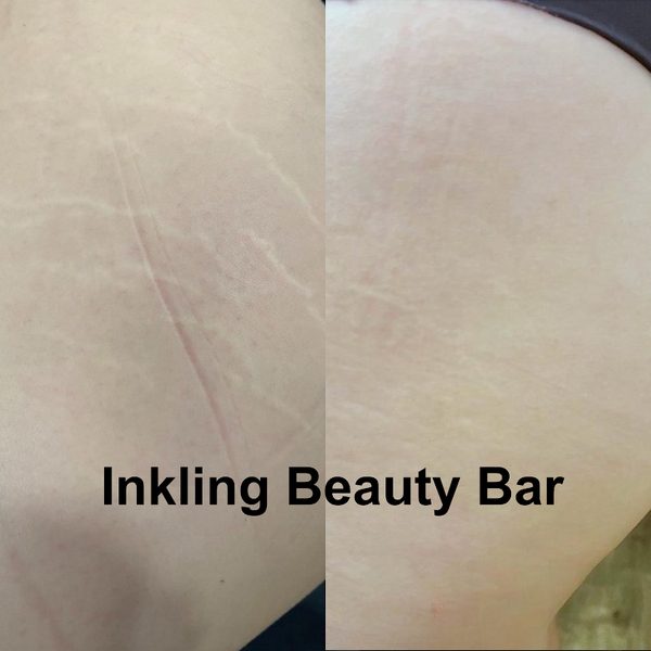 Inkling Beauty Bar