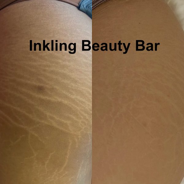 Inkling Beauty Bar