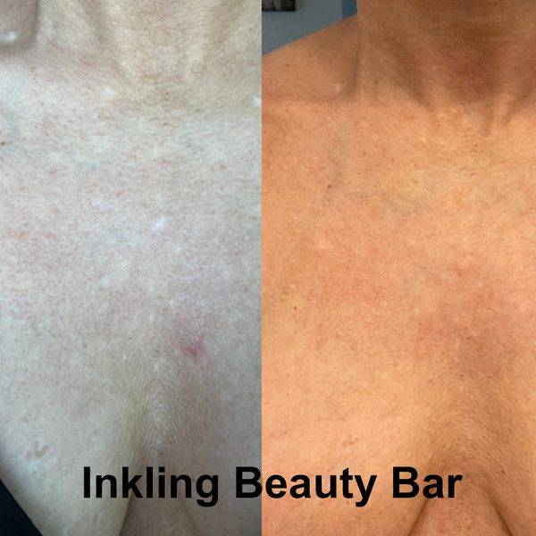 Inkling Beauty Bar