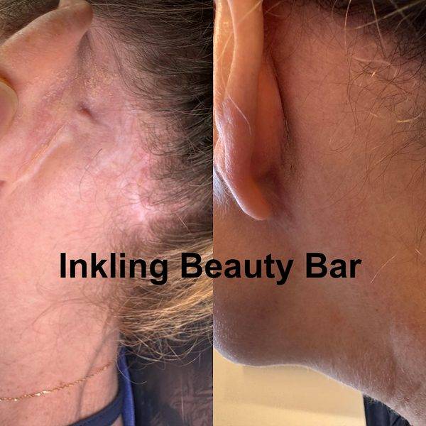 Inkling Beauty Bar