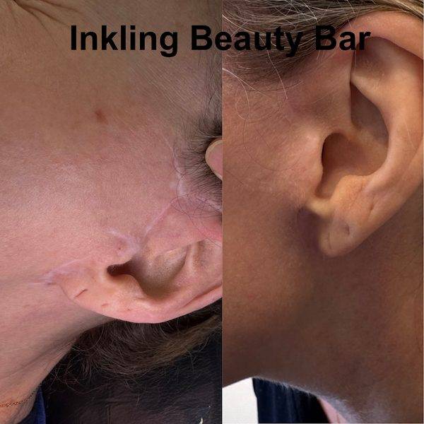 Inkling Beauty Bar
